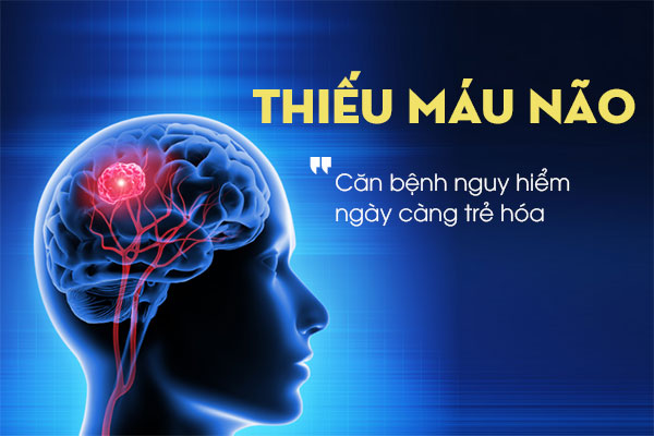 thiểu năng tuần hoàn não